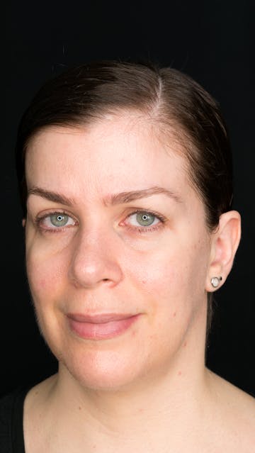 LG Led Mask Bare Face October 2018 - Bonnie Garner