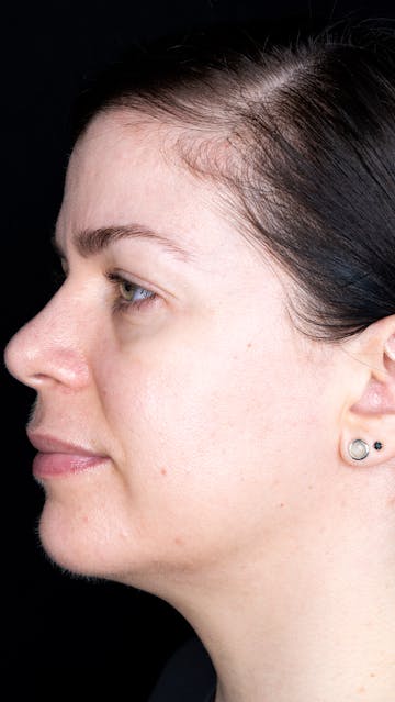 Bonnie Garner January 2020 Left Side