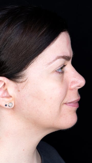 Bonnie Garner January 2020 Right Side