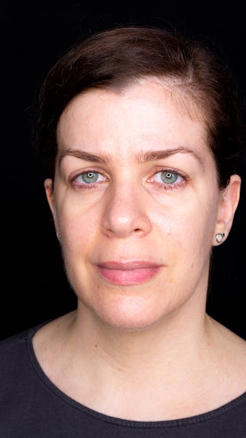 Bonnie Garner November 2019 Front View