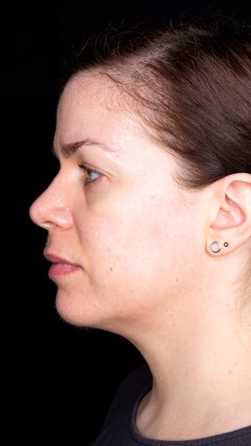 Bonnie Garner November 2019 Left Side