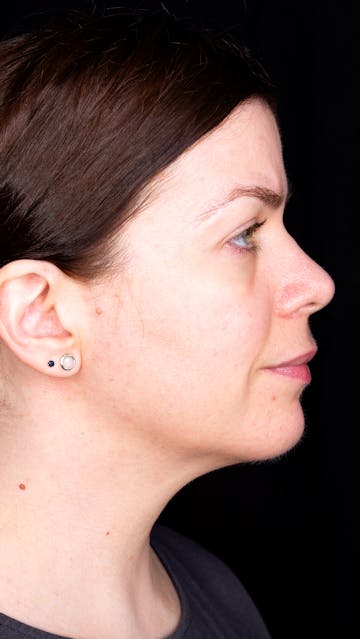 Bonnie Garner November 2019 Right Side